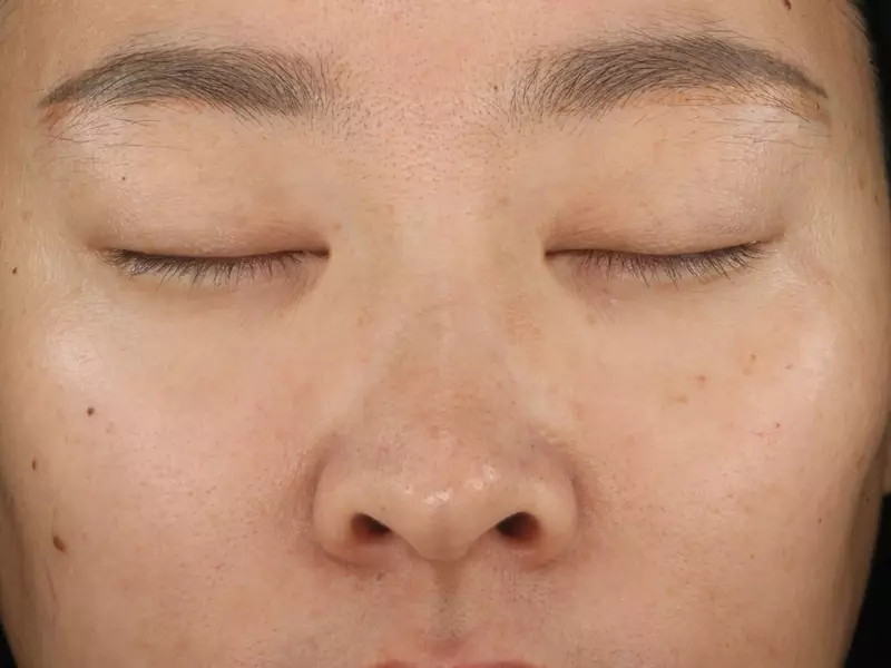 Second Image