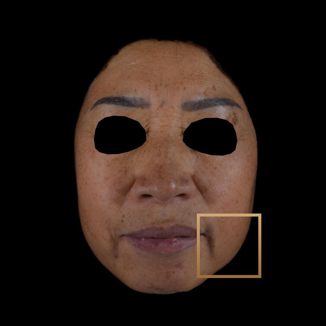 After 1 jar Result Image