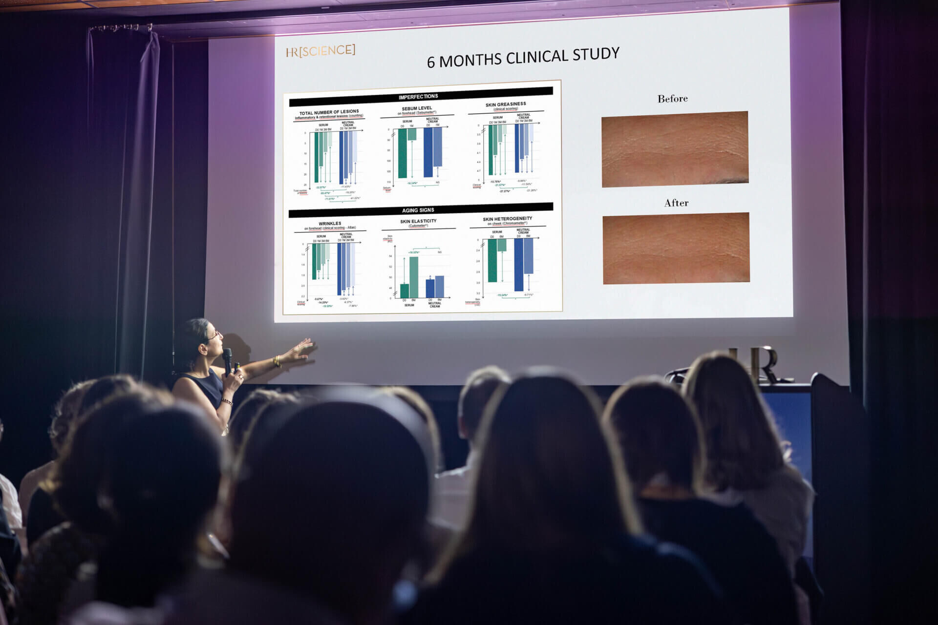 Ozone, The new frontier in skin stress