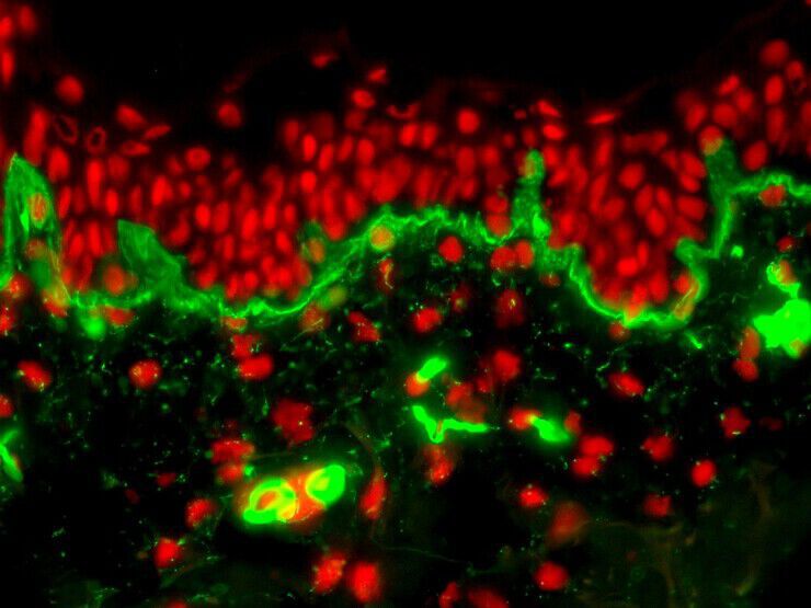 Pro-XylaneTM in a Bandage Cream Technology Image