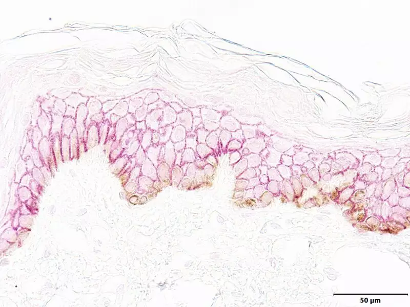 First Image